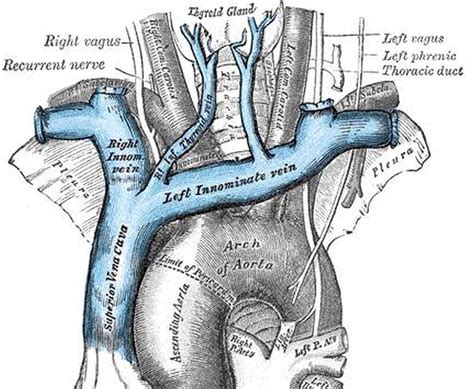 Pictures Of Brachiocephalic Vein(s)Healthiack