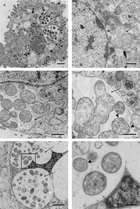 Transmission electron micrographs of Ehrlichia canis-infected cells. E ...