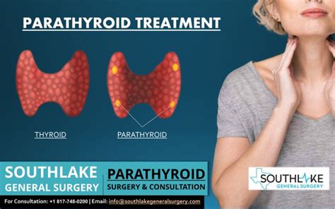 Parathyroid Treatment and Consultation - Southlake General Surgery