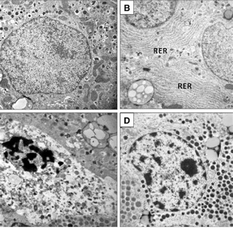 a Electron microscopy of a normal pancreatic beta cell showing ...