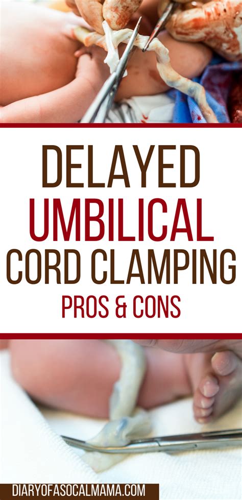 Delayed cord clamping: What's the big deal? | Delayed cord clamping, Cord clamping, Baby ...