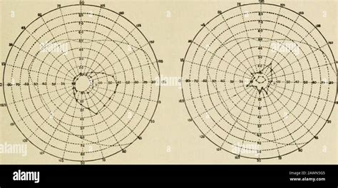 Cupping marks hi-res stock photography and images - Alamy