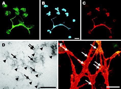 Neutrophil Extracellular Traps Kill Bacteria | Science