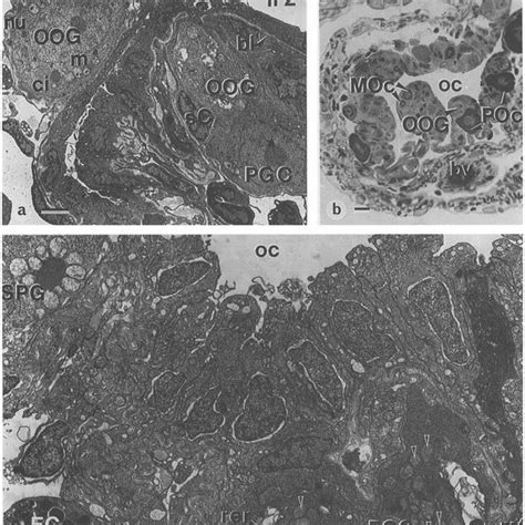 Ovotestis of one-year-old juvenile with ovarian prevalence ...