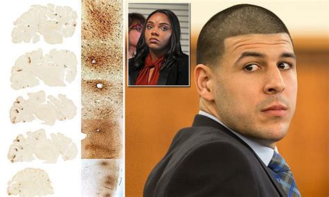 Aaron Hernandez did have CTE | Daily Mail Online