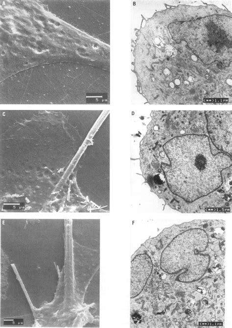 Scanning and transmission electron microscopy of HMC. (A) and (B) show ...