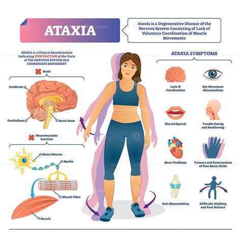 Ataxia vector illustration - VectorMine