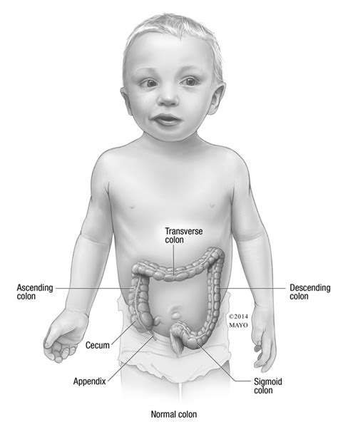 Pediatric Appendicitis | 2014-10-01 | AHC Media:… | Relias Media