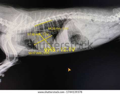 Left Lateral Recumbent View Check Thoracic Stock Photo 1744139378 | Shutterstock