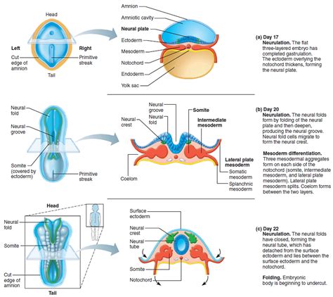 Spina Bifida - Causes, Symptoms, Types, Life Expectancy, Treatment