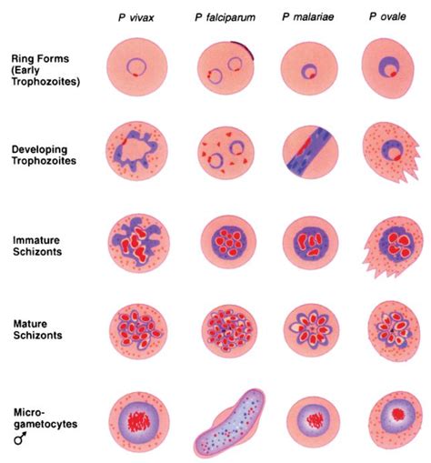 AI carries the torch of Malaria diagnosis in Taiwan Taiwan AILabs