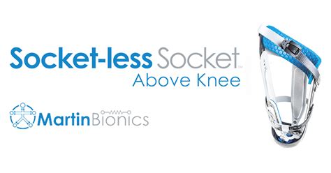 Above Knee Socket-less Socket™ — Martin Bionics