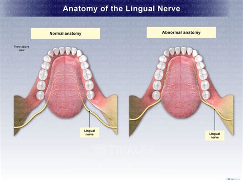 Anatomy of the Lingual Nerve - TrialExhibits Inc.