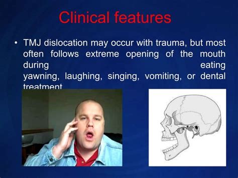 Clinical features of tmj dislocation