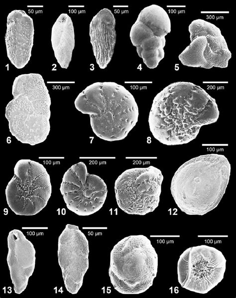 Scanning electron microscope images of foraminifera from San Diego... | Download Scientific Diagram