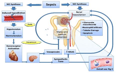 Septic Shock: Causes, Symptoms Treatment | atelier-yuwa.ciao.jp