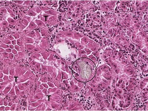 Calcium oxalate crystals in the kidneys. - Healthy Wildlife