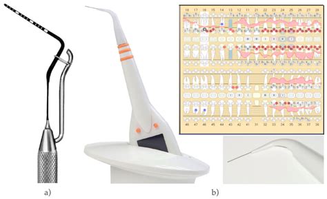 Periodontal Probe Measurements