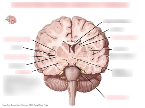 Coronal Brain Section Anterior to Thalamus Diagram | Quizlet