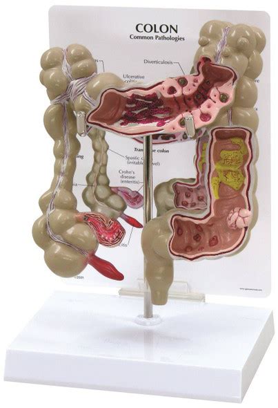 Transverse Colon Diagram