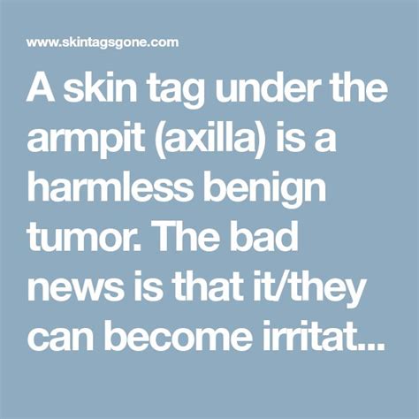 A skin tag under the armpit (axilla) is a harmless benign tumor. The bad news is that it/they ...