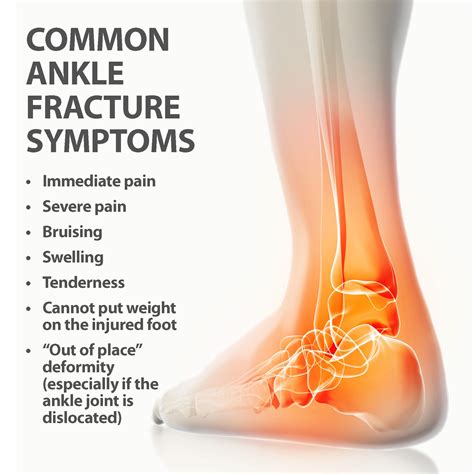 Fracture Broken Ankle Sprain