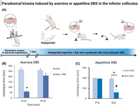 Paradoxical kinesia may no longer be a paradox waiting for 100 years to ...