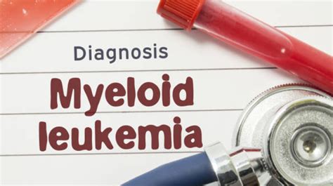 Acute Myeloid Leukemia Symptoms, Signs, Causes, And Treatments