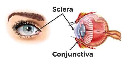 Difference Between Sclera And Conjunctiva - GeeksforGeeks