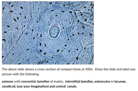 SOLVED: BONE HISTOLOGY: Draw the slide and label you picture with the following: osteons with ...