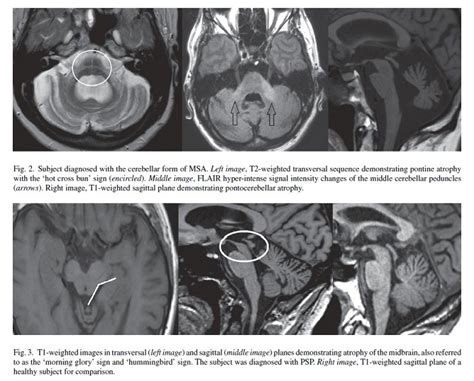 Clinical Application of Brain MRI in the Diagnostic Work-up of ...