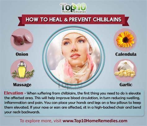 How to Heal and Prevent Chilblains | Top 10 Home Remedies