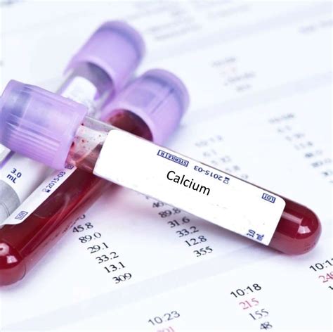 Calcium Blood Test In London - Order Online - Attend Clinic – Blood ...