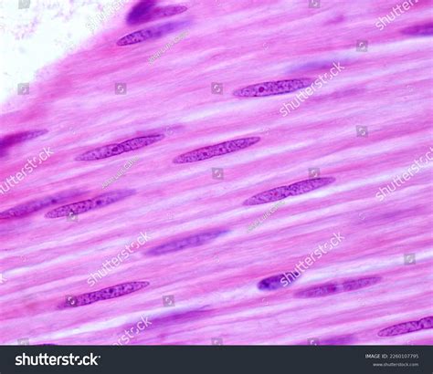 Smooth Muscle Under Microscope Labeled