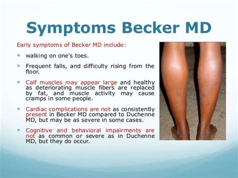 Gene therapy for muscular dystrophy