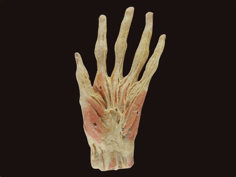 Superficial palmar arch plastinated specimens,anatomy model,anatomy ...