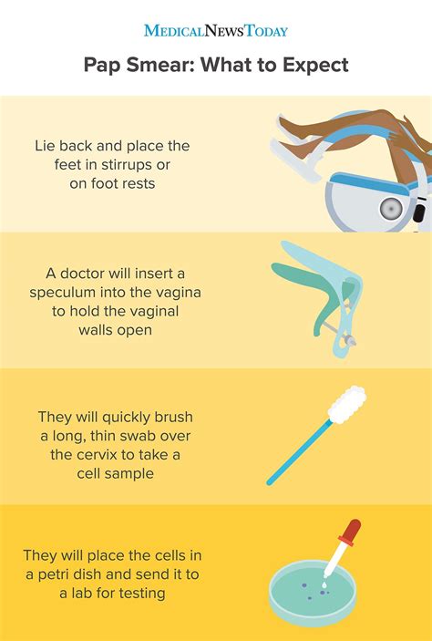 Pap smear: What is it, what happens, and results