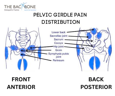 Pelvic Pain In Pregnancy