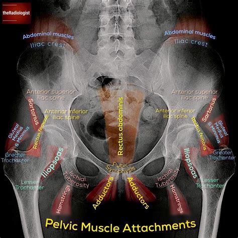 Iliac Crest Muscle Attachments