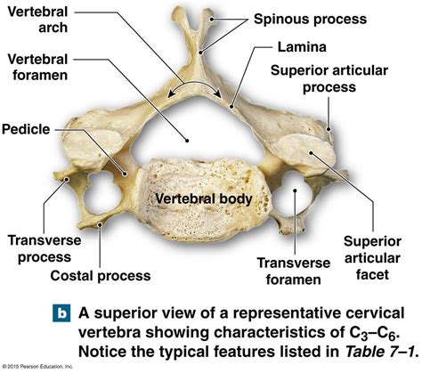 Major components of a typical vertebrae and the vertebral canal. | Medical anatomy, Human bones ...