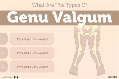 Genu Valgum: Causes, Symptoms, Treatment and Cost