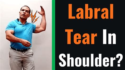 Labral Tear In Shoulder | Symptoms, Treatment, & Exercises