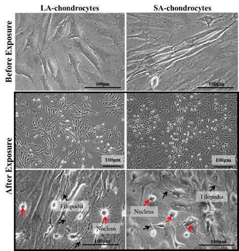 The morphology of chondrocytes before and after 3 days of exposure to ...