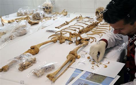 Forensic Scientist Examines Human Remains Forensics Editorial Stock Photo - Stock Image ...