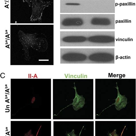 Mutant MEF cells display abnormal stress fibers and fewer focal... | Download Scientific Diagram