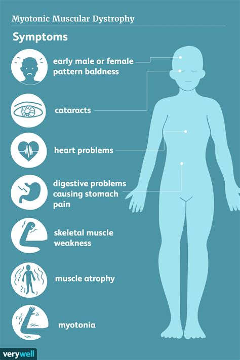 Myotonic Muscular Dystrophy: Symptoms, Causes, Diagnosis, Treatment ...