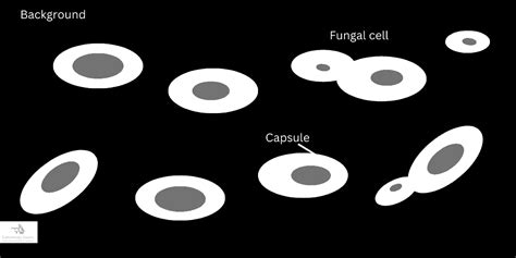 Negative staining procedure, principle, and results