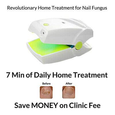 Nail Fungus Laser Device Home Anti Fungal Treatment Grey Toe Nail Clean Device | eBay