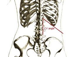 Costovertebral Angle the acute angle formed on either side of the human ...