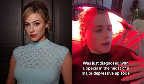 WATCH: Riverdale Actor Lili Reinhart Reveals Alopecia Diagnosis On TikTok